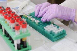 blutproben werden in einem labor untersucht