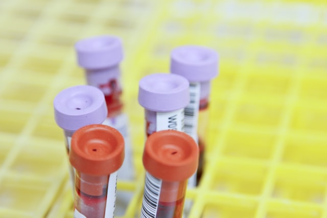Saarländische Testwoche „HIV & Co. Lass dich testen – kostenlos“
