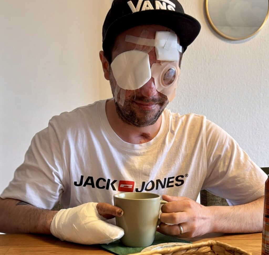 Manchmal reicht eine einzige Sekunde. Und nichts ist mehr, wie es einmal war.